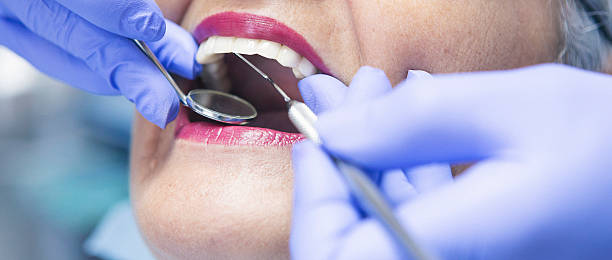 Best Emergency Wisdom Tooth Extraction in Sto Brook, NY
